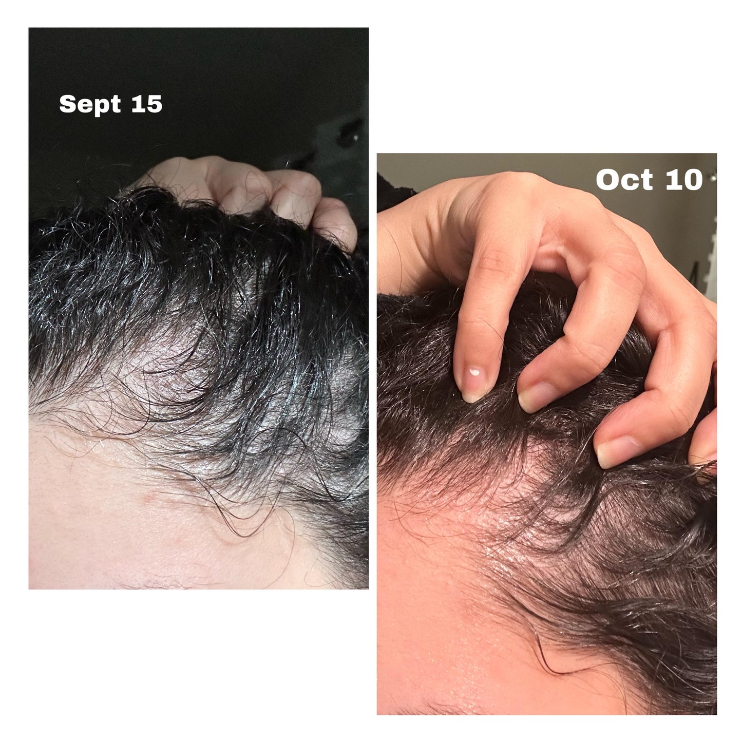 andbeautycare - The Ordinary Multi-Peptide Hair Growth Serum 60ml